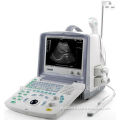Good quality white best portable ultrasound machine on sale
